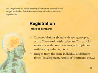 18
Registration
• Two populations (blind with seeing people,
active 70-year-old with sedentary 70-year-old,
musicians with non-musicians, schizophrenic
with healthy subjects, etc..)
• Images from the same individual at different
times (development, results of treatment, etc…)
Used to compare:
For the project on preprocessing of structural and diffusion
images we had to familiarize ourselves with the concept of
registration.
 