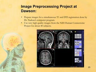 23
• Prepare images for a simultaneous T1 and DTI registration done by
Dr. Nadeau’s computer program.
• Use very high quality images from the NIH Human Connectome
Project for about 40 subjects.
Image Preprocessing Project at
Dawson:
 