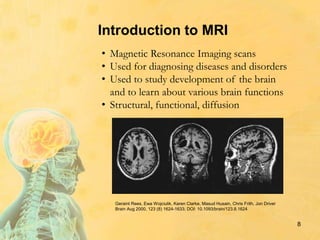 Introduction to MRI
8
• Magnetic Resonance Imaging scans
• Used for diagnosing diseases and disorders
• Used to study development of the brain
and to learn about various brain functions
• Structural, functional, diffusion
Geraint Rees, Ewa Wojciulik, Karen Clarke, Masud Husain, Chris Frith, Jon Driver
Brain Aug 2000, 123 (8) 1624-1633; DOI: 10.1093/brain/123.8.1624
 