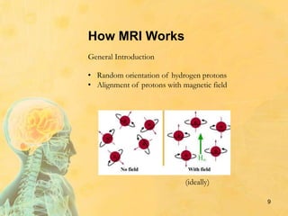 How MRI Works
• Random orientation of hydrogen protons
• Alignment of protons with magnetic field
General Introduction
(ideally)
9
 