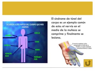 El síndrome de túnel del
carpo es un ejemplo común
de esto: el nervio en el
medio de la muñeca se
comprime y finalmente se
lesiona.
 