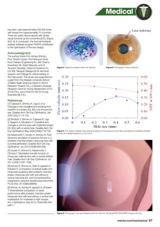 mentor.com/mechanical 67
has been used approximately 200,000 times
with lenses from approximately 70 countries.
There are useful clinical reports with similar
visual functions as the conventional ICL (Figure
8) [5, 6]. In conclusion, the thermal–hydraulic
analysis software program FloEFD contributed
to the optimization of the lens design.
Acknowledgment
The authors thank Prof. Kimiya Shimizu,
Prof. Hiroshi Uozato, Prof Nobuyuki Shoji,
Kozo Keikaku Engineering Inc. (Mr. Osamu
Kuwahara, Mr. Soichi Masuda, and Dr.
Tsuyoshi Yamada), Cybernet Systems Co.,
Ltd. (Mr. Takayuki Sakaguchi) for technical
support, and Editage for critical reading of
the manuscript. This study was supported by
a grant from the Kitasato University School
of Allied Health Sciences (Grant-in-Aid for
Research Project) (T.K.), a Kitasato University
Research Grant for Young Researchers 2010-
2016) (T.K.), and a Grant-in-Aid for Young
Scientists (B) (T.K.).
References
[1] Fujisawa K, Shimizu K, Uga S, et al.
Changes in the crystalline lens resulting from
insertion of a phakic IOL (ICL) into the porcine
eye. Graefes Arch Clin Exp Ophthalmol. Jan
2007;245(1):114-122.
[2] Shiratani T, Shimizu K, Fujisawa K, Uga
S, Nagano K, Murakami Y. Crystalline lens
changes in porcine eyes with implanted phakic
IOL (ICL) with a central hole. Graefes Arch Clin
Exp Ophthalmol. May 2008;246(5):719-728.
[3] Kawamorita T, Uozato H, Shimizu K. Fluid
dynamics simulation of aqueous humour in a
posterior-chamber phakic intraocular lens with
a central perforation. Graefes Arch Clin Exp
Ophthalmol. Jun 2012;250(6):935-939.
[4] Uozato H, Shimizu K, Kawamorita T,
Ohmoto F. Modulation transfer function of
intraocular collamer lens with a central artificial
hole. Graefes Arch Clin Exp Ophthalmol. Jul
2011;249(7):1081-1085.
[5] Kamiya K, Shimizu K, Saito A, Igarashi A,
Kobashi H. Comparison of optical quality and
intraocular scattering after posterior chamber
phakic intraocular lens with and without a
central hole (Hole ICL and Conventional ICL)
implantation using the double-pass instrument.
PLoS One. 2013;8(6):e66846.
[6] Shimizu K, Kamiya K, Igarashi A, Shiratani
T. Intraindividual comparison of visual
performance after posterior chamber phakic
intraocular lens with and without a central hole
implantation for moderate to high myopia.
Am J Ophthalmol. Sep 2012;154(3):486-494
e481.1
Figure 5. Trajectory analysis within the Hole-ICL
Figure 5. The relation between hole sizes and velocity of the aqueous humor fluid, including the modulation transfer
function at a spatial frequency of 100 c/mm
Figure 8. Photograph of an eye implanted with the Hole ICL KS-AquaPORTTM (STARR Surgical CO Ltd.)
Figure 6. Photograph of laser iridotomy
Medical
 