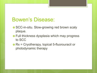 Bowen’s Disease:
 SCC-in-situ. Slow-growing red brown scaly
plaque.
 Full thickness dysplasia which may progress
to SCC
 Rx = Cryotherapy, topical 5-fluorouracil or
photodynamic therapy
 