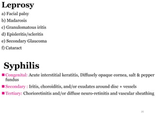 Leprosy
a) Facial palsy
b) Madarosis
c) Granulomatous iritis
d) Episleritis/scleritis
e) Secondary Glaucoma
f) Cataract
Syphilis
 Congenital: Acute interstitial keratitis, Diffusely opaque cornea, salt & pepper
fundus
 Secondary : Iritis, choroiditis, and/or exudates around disc + vessels
 Tertiary: Chorioretinitis and/or diffuse neuro-retinitis and vascular sheathing
20
 