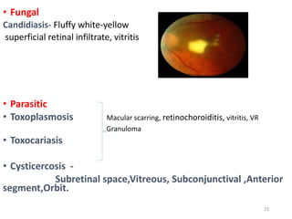 • Fungal
Candidiasis- Fluffy white-yellow
superficial retinal infiltrate, vitritis
• Parasitic
• Toxoplasmosis Macular scarring, retinochoroiditis, vitritis, VR
Granuloma
• Toxocariasis
• Cysticercosis -
Subretinal space,Vitreous, Subconjunctival ,Anterior
segment,Orbit.
23
 