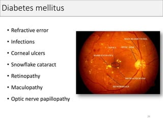 Diabetes mellitus
• Refractive error
• Infections
• Corneal ulcers
• Snowflake cataract
• Retinopathy
• Maculopathy
• Optic nerve papillopathy
26
 