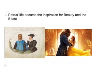  Petrus’ life became the inspiration for Beauty and the
Beast
 