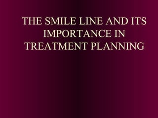 THE SMILE LINE AND ITS
IMPORTANCE IN
TREATMENT PLANNING
 