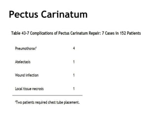 Pectus Carinatum
 
