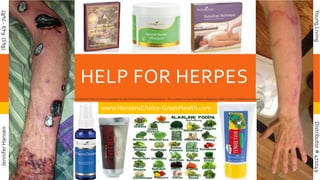 HELP FOR HERPES
www.HansensChoice-GreenHealth.com
(845)649-7487JenniferHansen
Distributor#471049YoungLiving
* This statement has not been evaluated by the Food and Drug Administration .This product is not intended to diagnose, treat, cure, or prevent any disease.
 