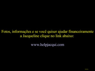 Fotos, informações e se você quiser ajudar financeiramente a Jacqueline clique no link abaixo:  www. helpjacqui .com >>> 