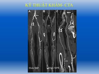 Comprehensive Diagnostic Imaging and Pathology of Lower Limb Arteries | PDF