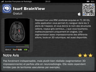 Isurf BrainView
Journées Françaises de Radiologie 20:13 91%
Gratuit
Notre Avis
Reposant sur une IRM cérébrale acquise en T1 3D EG,
cette application vous permet d’y naviguer dans les 3
plans de l’espace, et vous donne le nom des structures
(sillons, noyaux gris centraux,…) que vous toucherez,
malheureusement uniquement en anglais. Une
segmentation assez impressionnante des différents
sillons, toute en 3D volumique, est aussi disponible.
Pas forcément indispensable, mais plutôt bien réalisée (segmentation 3D
impressionnante) et parfois utile en neuroradiologie. Elle reste cependant
limitée (pas de territoires vasculaires par exemple).
 