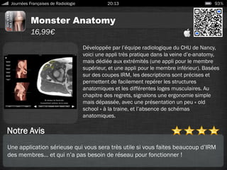 Monster Anatomy
Journées Françaises de Radiologie 20:13 93%
16,99€
Notre Avis
Développée par l’équipe radiologique du CHU de Nancy,
voici une appli très pratique dans la veine d’e-anatomy,
mais dédiée aux extrémités (une appli pour le membre
supérieur, et une appli pour le membre inférieur). Basées
sur des coupes IRM, les descriptions sont précises et
permettent de facilement repérer les structures
anatomiques et les différentes loges musculaires. Au
chapitre des regrets, signalons une ergonomie simple
mais dépassée, avec une présentation un peu « old
school » à la traine, et l’absence de schémas
anatomiques.
Une application sérieuse qui vous sera très utile si vous faites beaucoup d’IRM
des membres… et qui n’a pas besoin de réseau pour fonctionner !
 