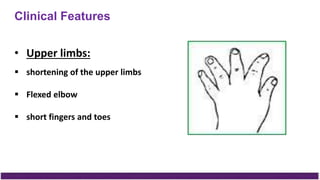 Clinical Features
• Upper limbs:
 shortening of the upper limbs
 Flexed elbow
 short fingers and toes
 
