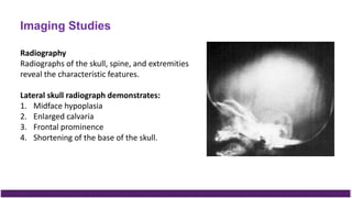 Imaging Studies
Radiography
Radiographs of the skull, spine, and extremities
reveal the characteristic features.
Lateral skull radiograph demonstrates:
1. Midface hypoplasia
2. Enlarged calvaria
3. Frontal prominence
4. Shortening of the base of the skull.
 