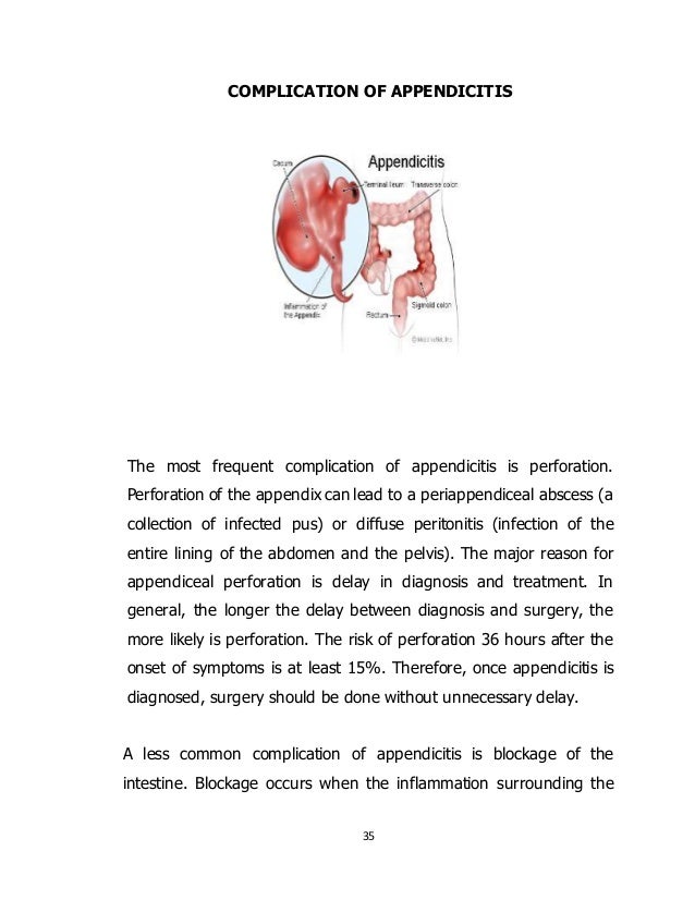 88887820 acasestudyonacuteappendicitis