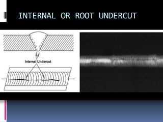INTERNAL OR ROOT UNDERCUT
 