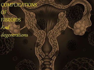 COMPLICATIONS
OF
FIBROIDS
And
degenerations
 