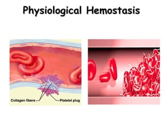 Physiological Hemostasis

 