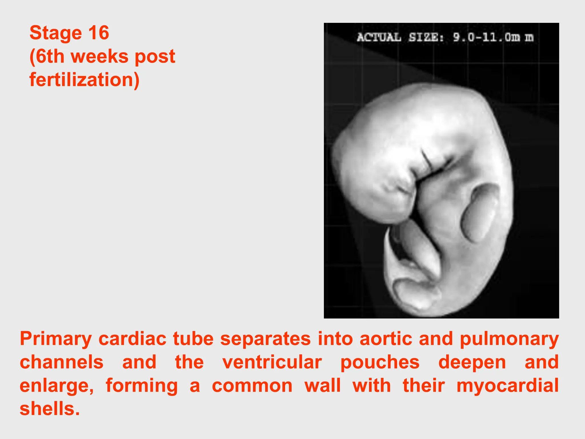 Stage 16
(6th weeks post
fertilization)
Primary cardiac tube separates into aortic and pulmonary
channels and the ventricular pouches deepen and
enlarge, forming a common wall with their myocardial
shells.
 