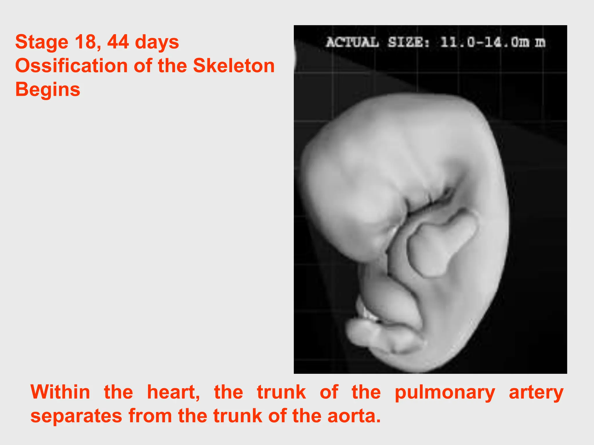 Within the heart, the trunk of the pulmonary artery
separates from the trunk of the aorta.
Stage 18, 44 days
Ossification of the Skeleton
Begins
 
