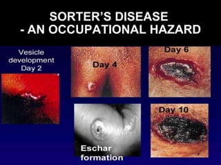 SORTER’S DISEASE - AN OCCUPATIONAL HAZARD