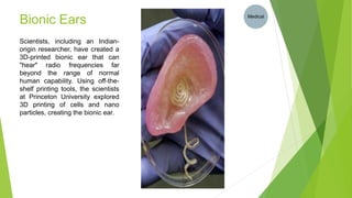 Bionic Ears
Scientists, including an Indian-
origin researcher, have created a
3D-printed bionic ear that can
"hear" radio frequencies far
beyond the range of normal
human capability. Using off-the-
shelf printing tools, the scientists
at Princeton University explored
3D printing of cells and nano
particles, creating the bionic ear.
Medical
 