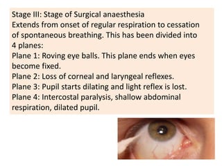 Stage III: Stage of Surgical anaesthesia
Extends from onset of regular respiration to cessation
of spontaneous breathing. This has been divided into
4 planes:
Plane 1: Roving eye balls. This plane ends when eyes
become fixed.
Plane 2: Loss of corneal and laryngeal reflexes.
Plane 3: Pupil starts dilating and light reflex is lost.
Plane 4: Intercostal paralysis, shallow abdominal
respiration, dilated pupil.
 