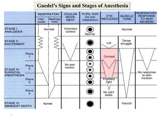 17
Guedel’s Signs and Stages of Anesthesia
 
