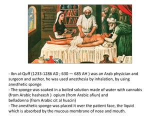 - Ibn al-Quff (1233-1286 AD ; 630 — 685 AH ) was an Arab physician and
surgeon and author, he was used anesthesia by inhalation, by using
anesthetic sponge
- The sponge was soaked in a boiled solution made of water with cannabis
(from Arabic hasheesh ) opium (from Arabic afiun) and
belladonna (from Arabic cit al huscin)
- The anesthetic sponge was placed it over the patient face, the liquid
which is absorbed by the mucous membrane of nose and mouth.
 