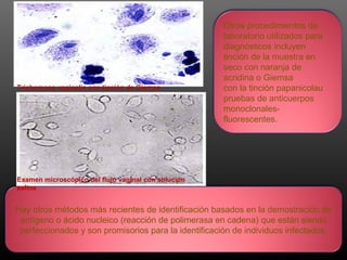 Otros procedimientos de
laboratorio utilizados para
diagnósticos incluyen
tinción de la muestra en
seco con naranja de
acridina o Giemsa
con la tinción papanicolau
pruebas de anticuerpos
monoclonales-
fluorescentes.
Hay otros métodos más recientes de identificación basados en la demostración de
antígeno o ácido nucleico (reacción de polimerasa en cadena) que están siendo
perfeccionados y son promisorios para la identificación de individuos infectados.
Examen microscópico del flujo vaginal con solución
salina
Trichomona vaginalis con tinción de Giemsa
 