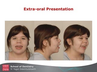 School of Dentistry
Yr Ysgol Ddeintyddiaeth
Extra-oral Presentation
 