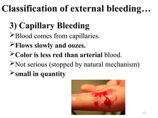 Comprehensive First Aid for Wounds and Bleeding Management | PPTX