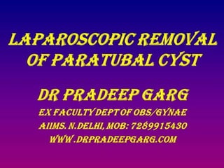 Paratubal Cyst:Laparoscopic removal :Dr Pradeep Garg