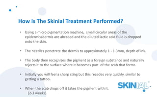 How Is The Skinial Treatment Performed?
• Using a micro pigmentation machine, small circular areas of the
epidermis/dermis are abraded and the diluted lactic acid fluid is dropped
onto the skin.
• The needles penetrate the dermis to approximately 1 - 1.3mm, depth of ink.
• The body then recognizes the pigment as a foreign substance and naturally
rejects it to the surface where it becomes part of the scab that forms.
• Initially you will feel a sharp sting but this recedes very quickly, similar to
getting a tattoo.
• When the scab drops off it takes the pigment with it.
(2-3 weeks).
 