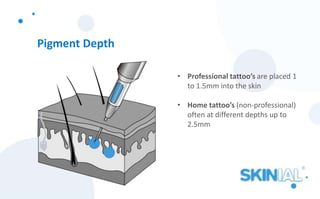 Pigment Depth
• Professional tattoo’s are placed 1
to 1.5mm into the skin
• Home tattoo’s (non-professional)
often at different depths up to
2.5mm
 