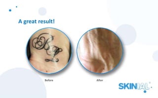 A great result!
Before After
 