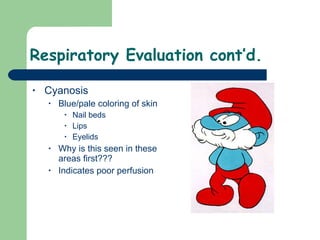 Respiratory Evaluation cont’d. Cyanosis Blue/pale coloring of skin Nail beds Lips Eyelids  Why is this seen in these areas first???  Indicates poor perfusion  