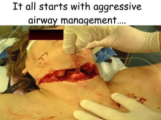 It all starts with aggressive airway management…. 