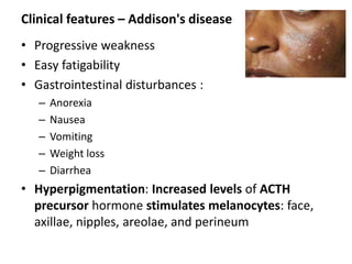 Clinical features – Addison's disease
• Progressive weakness
• Easy fatigability
• Gastrointestinal disturbances :
– Anorexia
– Nausea
– Vomiting
– Weight loss
– Diarrhea
• Hyperpigmentation: Increased levels of ACTH
precursor hormone stimulates melanocytes: face,
axillae, nipples, areolae, and perineum
 
