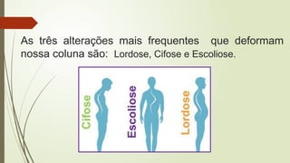 As três alterações mais frequentes que deformam
nossa coluna são: Lordose, Cifose e Escoliose.
 