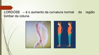 LORDOSE – é o aumento da curvatura normal da região
lombar da coluna.
 