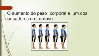O aumento do peso corporal é um dos
causadores da Lordose.
 