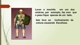 Levar a mochila em um dos
ombros, por exemplo, faz com que
o peso fique apenas de um lado.
Isto leva ao inclinamento da
coluna causando Escoliose.
 