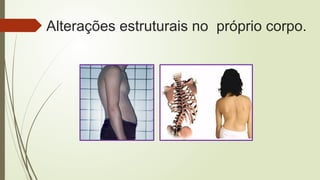 Alterações estruturais no próprio corpo.
 