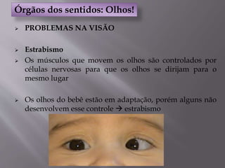  PROBLEMAS NA VISÃO
 Estrabismo
 Os músculos que movem os olhos são controlados por
células nervosas para que os olhos se dirijam para o
mesmo lugar
 Os olhos do bebê estão em adaptação, porém alguns não
desenvolvem esse controle  estrabismo
Órgãos dos sentidos: Olhos!
 