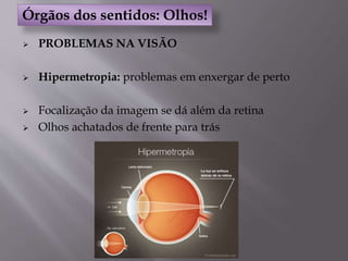  PROBLEMAS NA VISÃO
 Hipermetropia: problemas em enxergar de perto
 Focalização da imagem se dá além da retina
 Olhos achatados de frente para trás
Órgãos dos sentidos: Olhos!
 