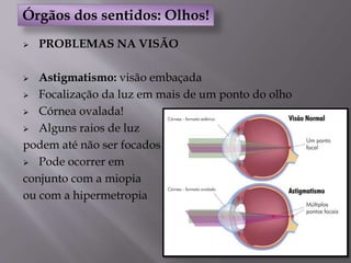  PROBLEMAS NA VISÃO
 Astigmatismo: visão embaçada
 Focalização da luz em mais de um ponto do olho
 Córnea ovalada!
 Alguns raios de luz
podem até não ser focados
 Pode ocorrer em
conjunto com a miopia
ou com a hipermetropia
Órgãos dos sentidos: Olhos!
 