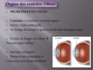  PROBLEMAS NA VISÃO
 Catarata: o cristalino se torna opaco
 Início: visão embaçada
 Ao longo do tempo a pessoa pode não enxergar mais
 Evolui ao longo dos anos 
Pessoas mais velhas
 Solução cirúrgica!
 Remove-se o cristalino e
Coloca-se uma lente artificial
Órgãos dos sentidos: Olhos!
 